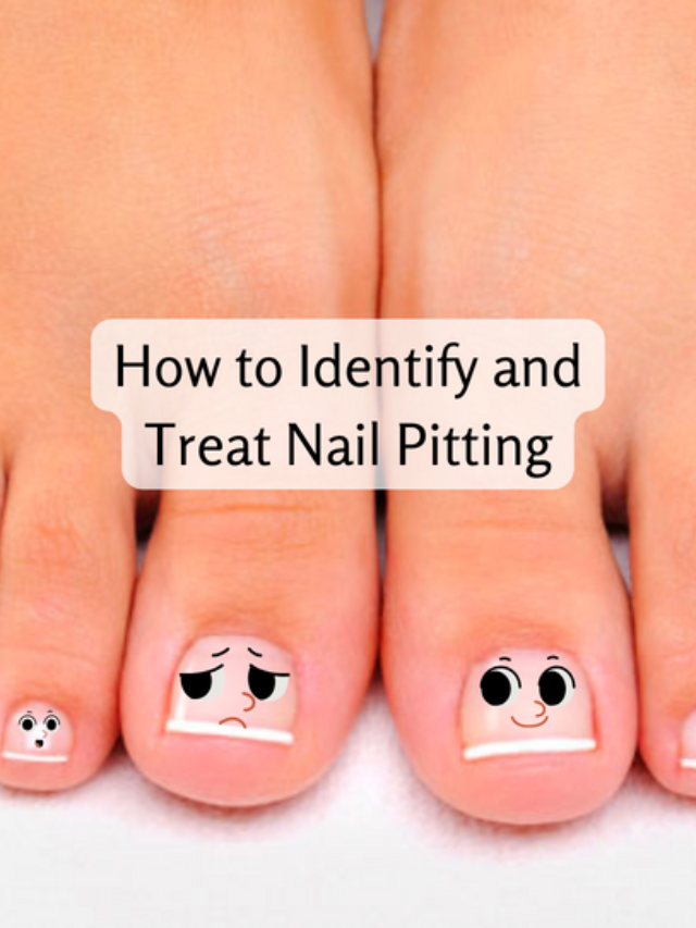 How to Identify and Treat Nail Pitting